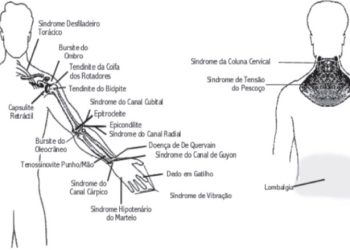 Lesões Músculo-Esqueléticas relacionadas com o Trabalho: (como) causa do ABSENTISMO LABORAL